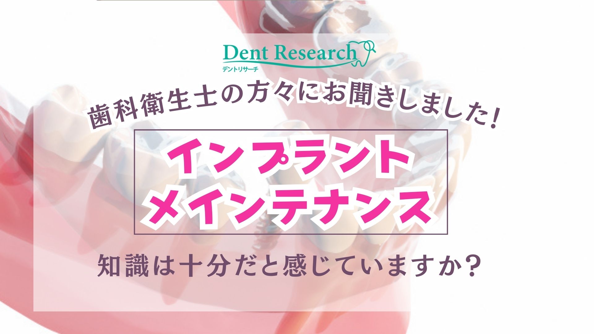 歯科衛生士の方々にお聞きしました！  「インプラントメインテナンス」 知識は十分だと感じていますか？